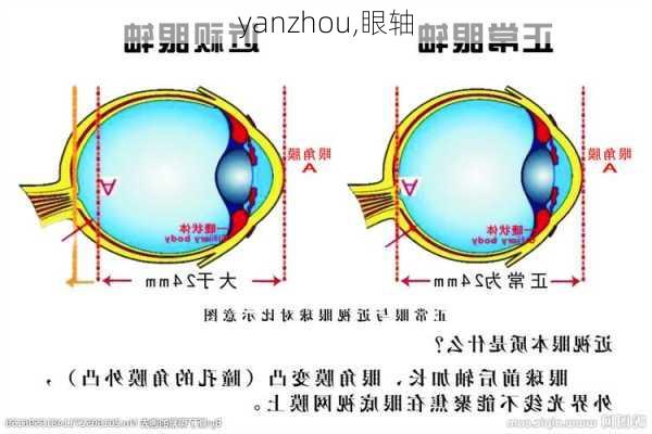 yanzhou,眼轴-第1张图片-呼呼旅行网